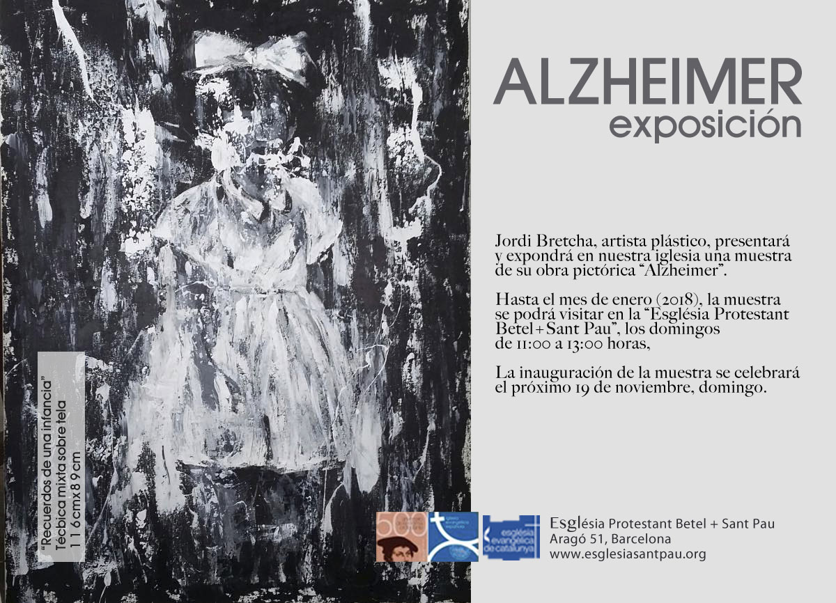 alzheimer